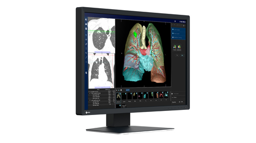 EIZO 61.2 cm LCD TV - 609.60 mm Class
